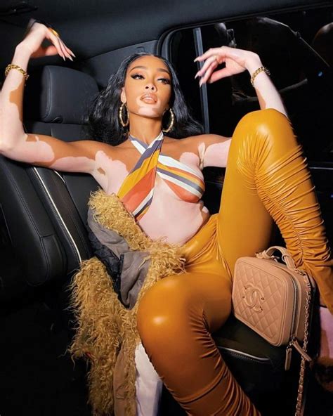 winnie harlow show her tits braless at 818 tequilla party 14 photos
