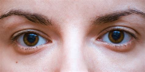 8 Causes Of Tired Eyes That Have Nothing To Do With Sleep—and What You
