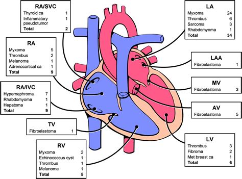 cardiac tumours diagnosis  management heart