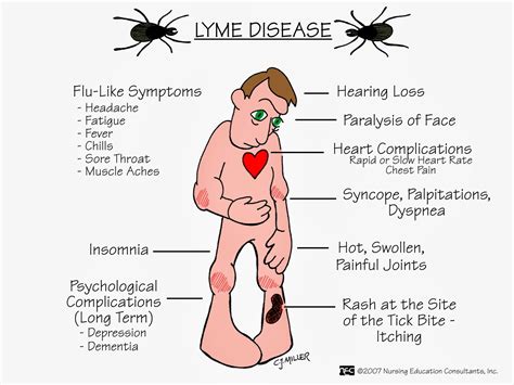 lyme disease world  desire