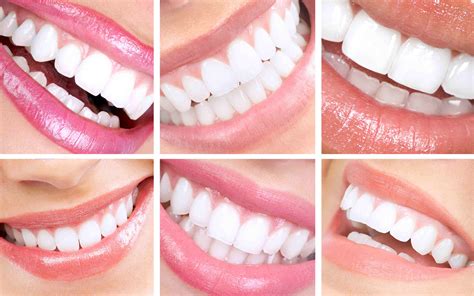 dental design smile procedure design talk