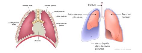 Infos Patients – Pneumologie Imm Institut Mutualiste Montsouris
