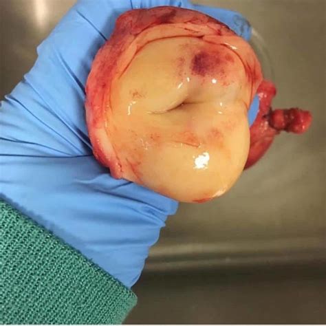 this is what a cervix looks like and it s incredible