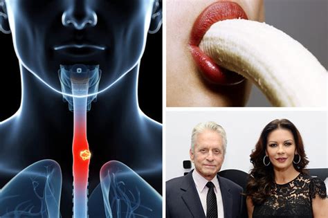 Oral Sex Linked To Neck And Throat Cancer Daily Star