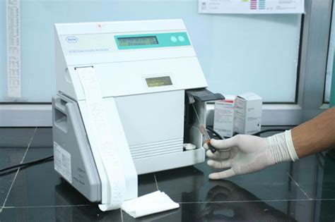 Roche avl 9100 electrolyte analyzer