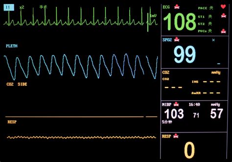 heart monitor machine silopetip