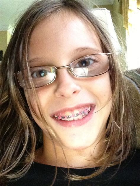 braces and glasses what a cutie pie braces and glasses beautiful