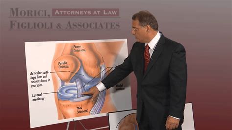 handling knee injuries with jim morici of morici figlioli and associates