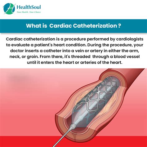 cardiac catheterization healthsoul