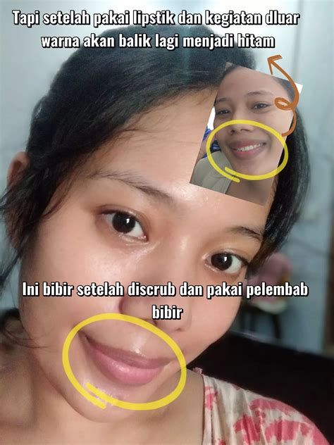 Bibir Jelek Dicap Perokok Berat😭 Galeri Diposting Oleh Muty Lemon8