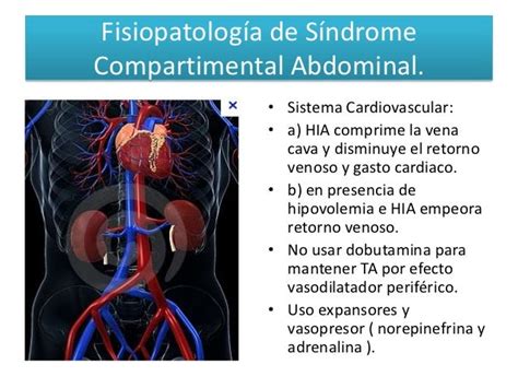 Fisiopatologia Sindrome Compartimental Abdominal Pdf