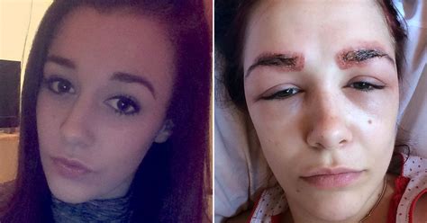 teen scarred  eyebrow tint treatment left