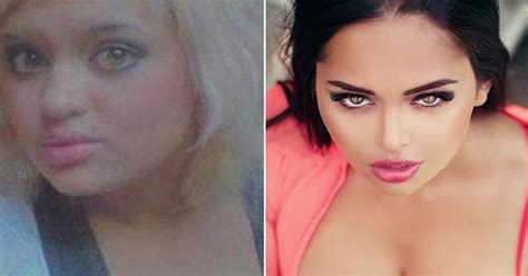 hot instagram models before and after plastic surgery