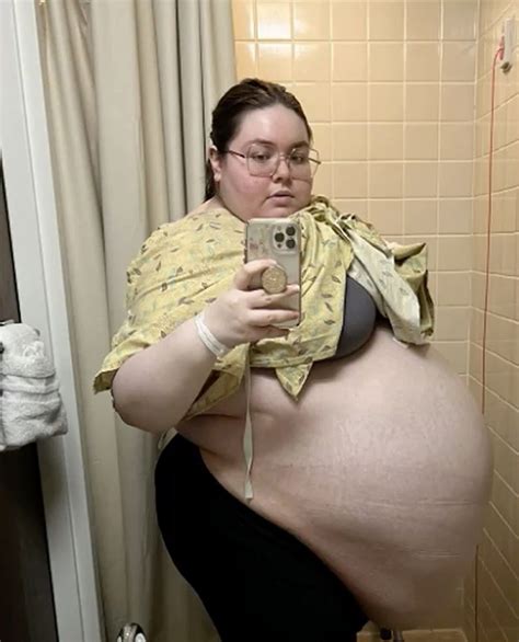 i gained weight and looked pregnant — it was a 104 pound ovarian cyst