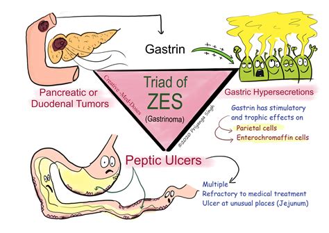 zollingerellison syndrome zes creative med doses