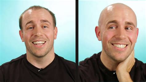 balding guys  completely bald youtube
