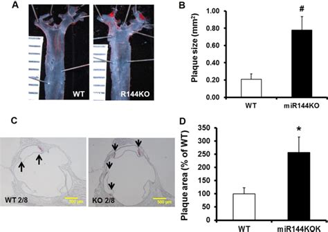 ablation of mir 144 increases vimentin expression and atherosclerotic