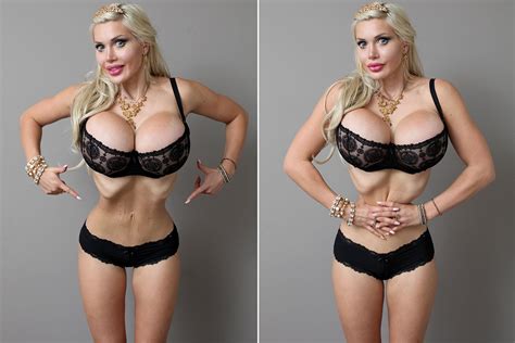 this woman removed her six ribs to look like a cartoon