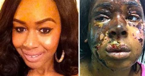 Naomi Oni Disfigured In Dagenham Acid Attack Victoria S Secret Worker