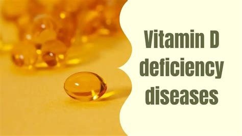 Vitamin D Deficiency Diseases Psyspeaks