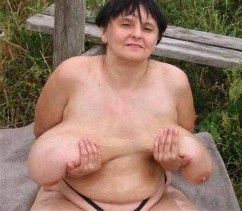 unusual nipples igfap