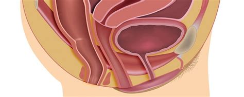 Diagnosis And Management Of Pelvic Organ Prolapse The Basics Women S