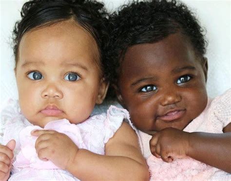 Incredible These 8 Strange Facts About Twins Will Make Your Jaw Drop