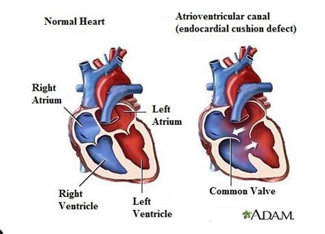 7 heart murmur symptoms you should know step to health