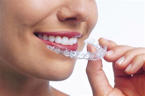 invisalign cleaning crystals northenden
