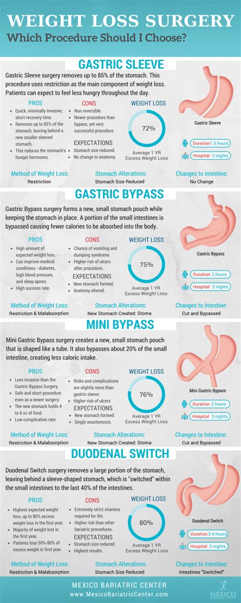 guide  types  bariatric weight loss surgery comparison table