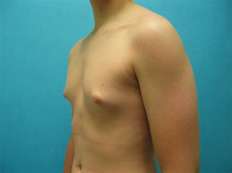 puberty budding breasts image 4 fap