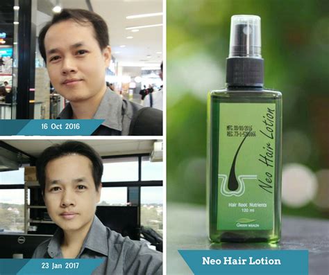 Neo Hair Lotion By Green Wealth Thailand Best Selling