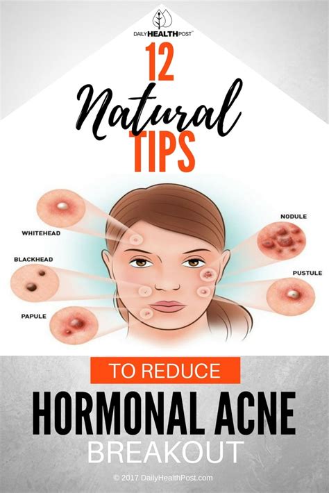 beat the breakout 12 naturals ways to get hormonal acne under control