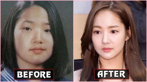 Plastic Surgery On The Rise In The U S And South Korea Her Campus