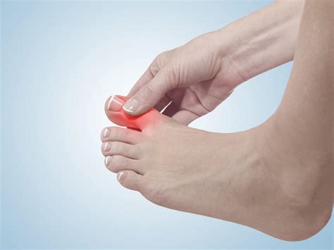 possibilities   big toe hurts community foot clinic  mcpherson