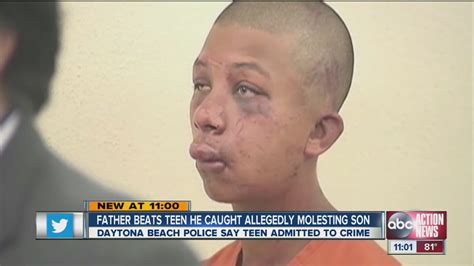 Father Beats Teen He Caught Allegedly Molesting Son Youtube