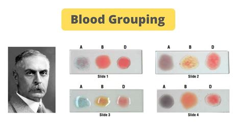 blood grouping test principle procedure result