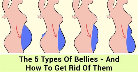 The Five Belly Types And How You Can Get Rid Of Them