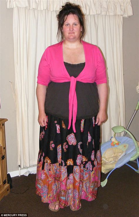 cornwall woman loses 12 stone and got size g breast