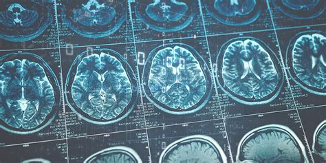 brain scans american health imaging