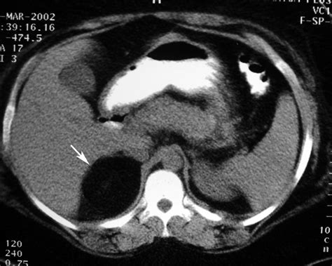 radiodiagnosis imaging  amazing interesting cases adrenal