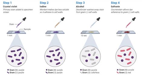 Gram Staining Principle Reagents Procedure Steps Results 2022