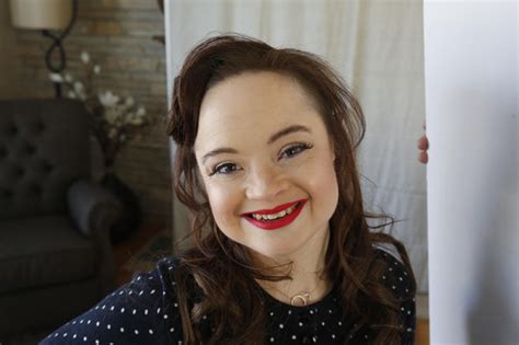 model with down s syndrome blasts lack of diversity but promises to