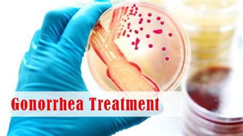 Gonorrhea Treatment In Lahore Causes And Symptoms Std