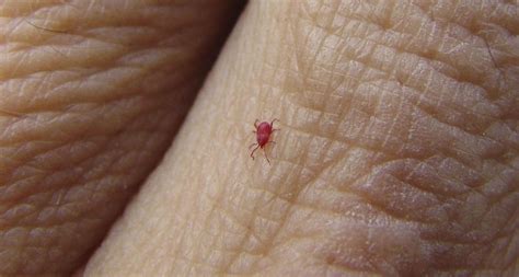 rid  chiggers eliminate red mites  bugs   yard