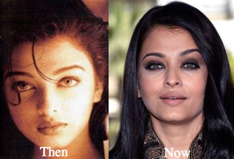Aishwarya Rai Plastic Surgery Before And After Photos