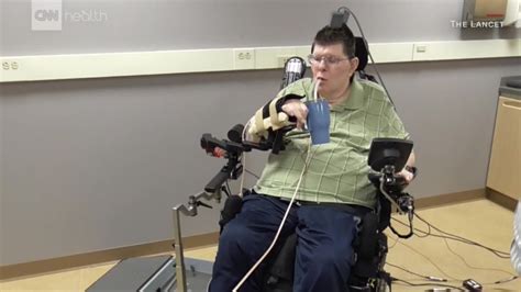 Exoskeleton Allows Paralyzed Man To Use Arm By Decoding His Brain Cnn