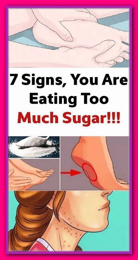 7 Signs You Are Eating Too Much Sugar Healhty And Tips