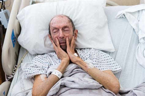 Elderly Hospital Patients Arrive Sick Often Leave Disabled