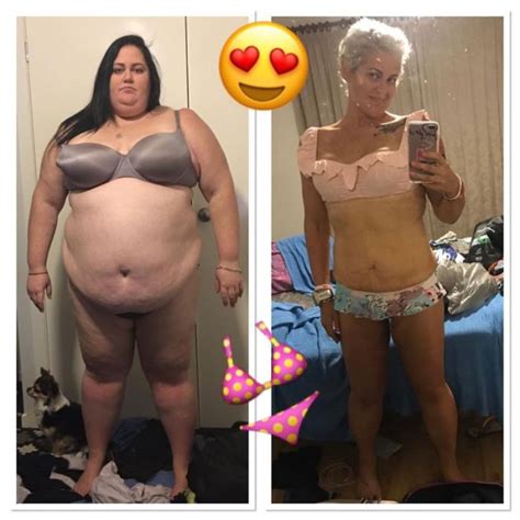 Woman Goes Through Incredible Transformation After Giving